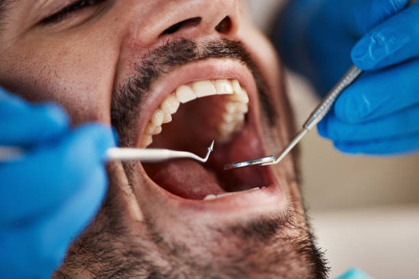 Best Emergency Treatment for Dental Infections or Abscesses in Concord, NH